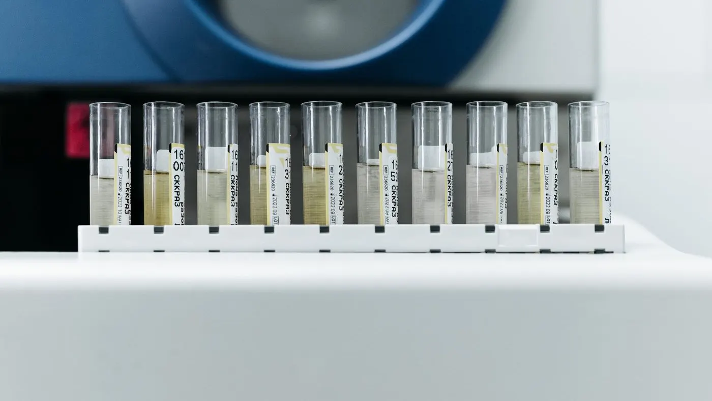 Hilera de tubos con muestras de color amarillento en una gradilla frente a un equipo de laboratorio: imagen para la guía de la microalbuminuria