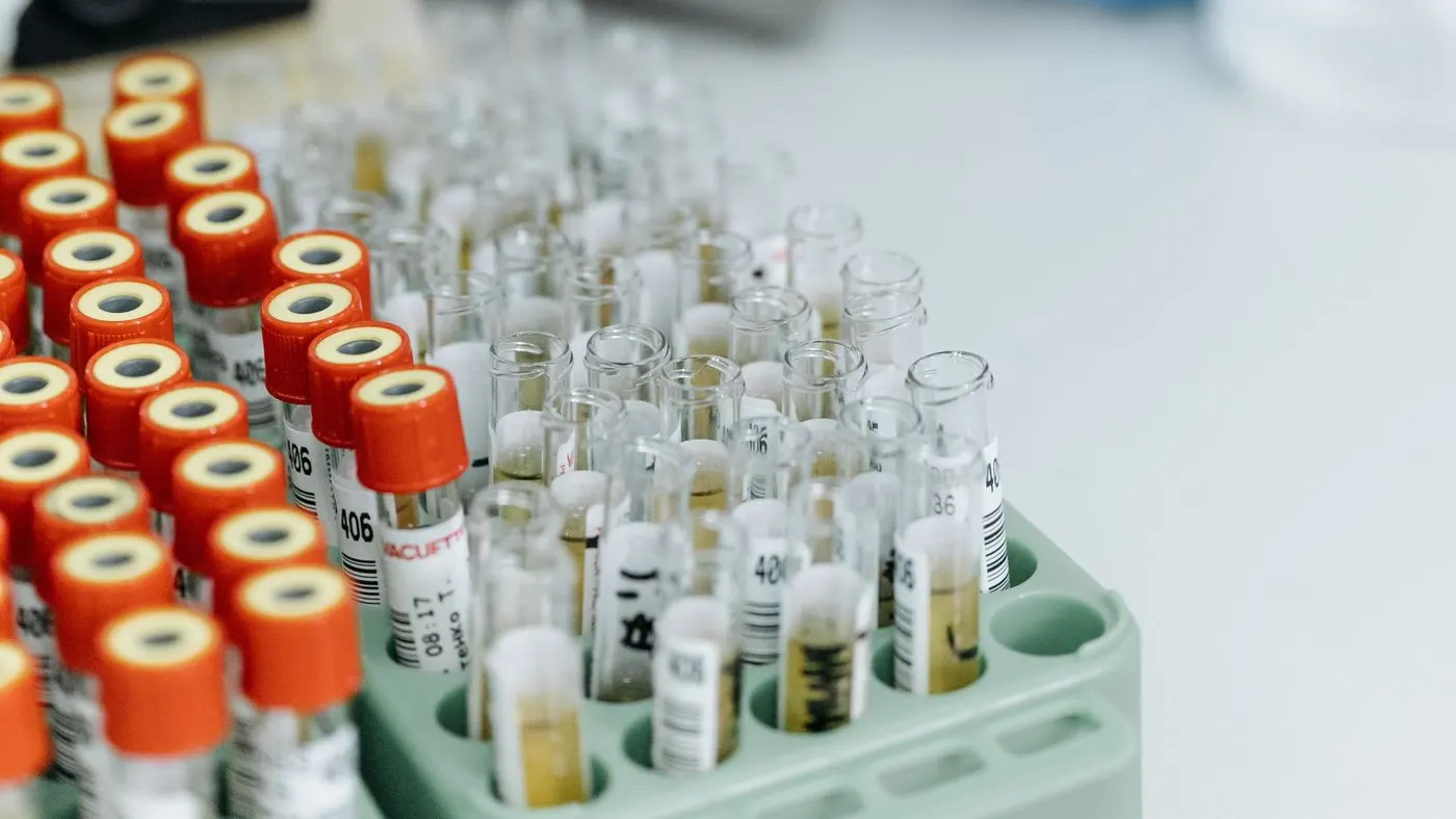 Tubos de sangre con tapa naranja en una gradilla y, al fondo, una persona de laboratorio con guantes azules sosteniendo una micropipeta: imagen para la guía del perfil lipídico