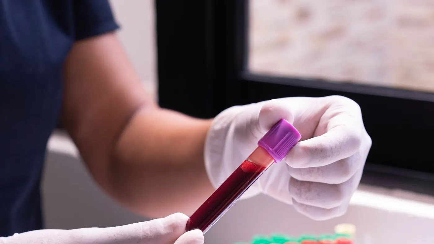 Manos con guantes que sostienen un tubo de sangre con tapa morada y, detrás, una gradilla con tubos de colores: imagen para la guía de la tasa de filtración glomerular